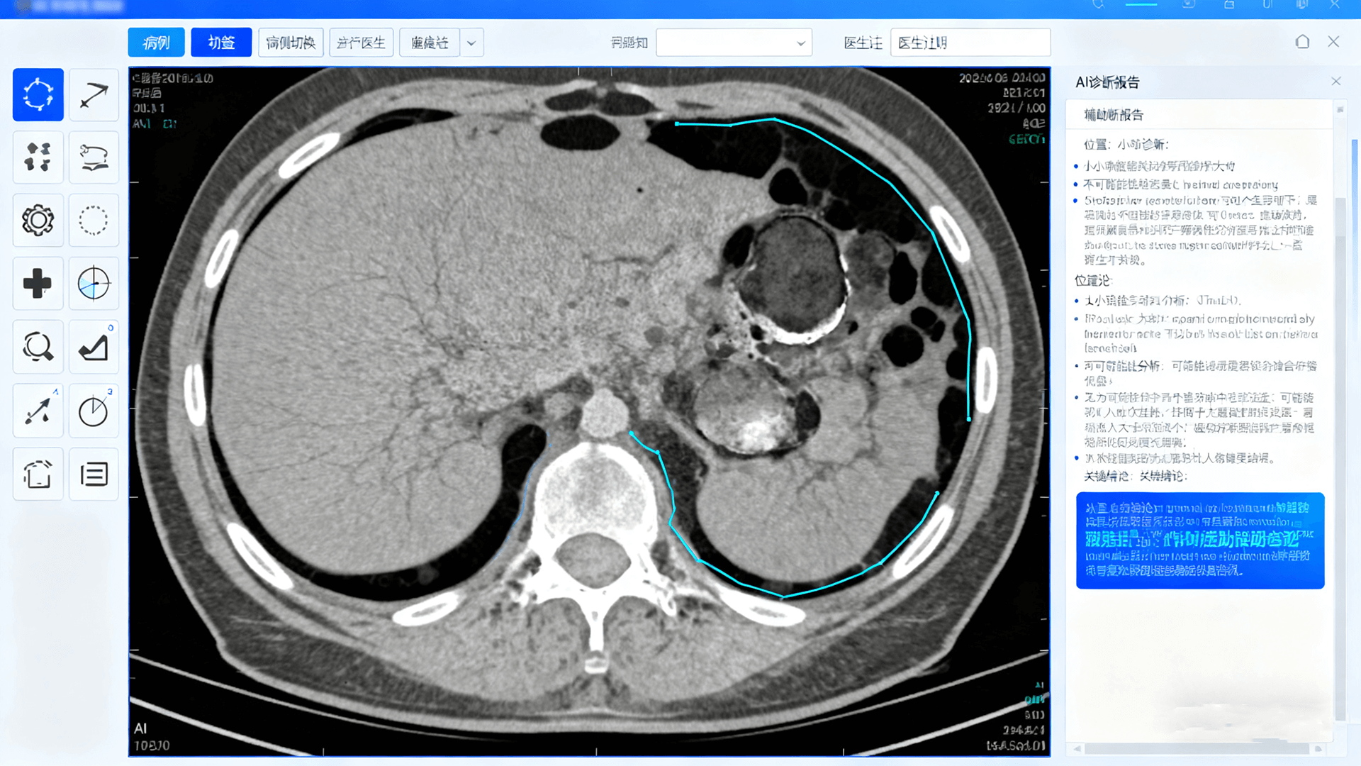 医疗数据分析平台
